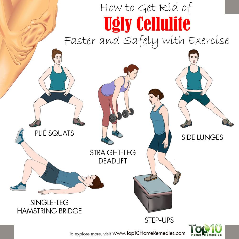 Oefening en cellulitis